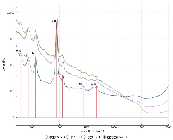 圖4 3例結(jié)石拉曼光譜.jpg
